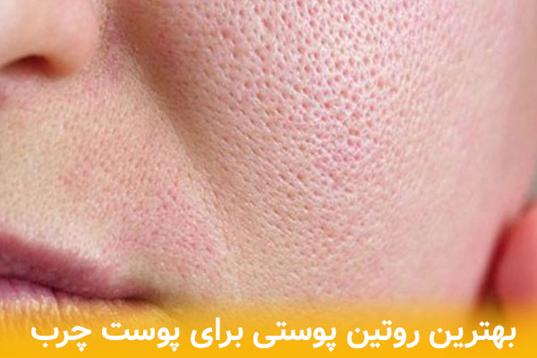 بهترین روتین پوستی برای پوست چرب