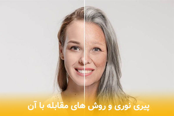 پیری نوری چیست؟
