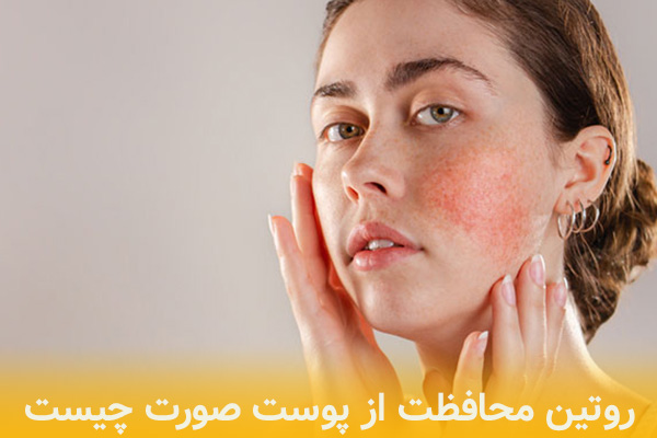 روتین محافظت از پوست صورت چگونه است